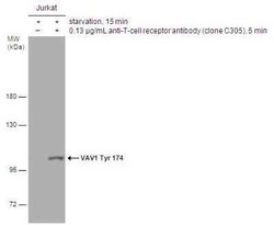 Vav-1, p Tyr174 Antibody, Novus Biologicals 100 &mu;g; Unconjugated:Antibodies,