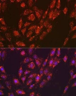 Versican Rabbit anti-Human, Mouse, Rat, Clone: 6D8K9, Novus Biologicals 100 &mu;g | Buy Online | Novus Biologicals | Fisher Scientific