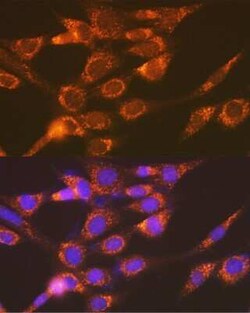 Versican Rabbit anti-Human, Mouse, Rat, Clone: 6D8K9, Novus Biologicals 100 &mu;g | Buy Online | Novus Biologicals | Fisher Scientific