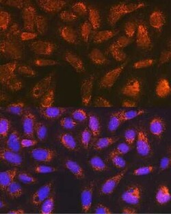 Versican Rabbit anti-Human, Mouse, Rat, Clone: 6D8K9, Novus Biologicals 100 &mu;g | Buy Online | Novus Biologicals | Fisher Scientific