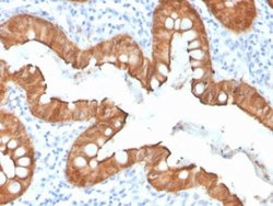 Villin 1 Rabbit anti-Human, Clone: VIL1/4107R, Novus Biologicals 20 &mu;g;