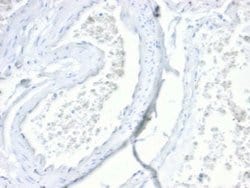 Villin 1 Rabbit anti-Human, Clone: VIL1/4107R, Novus Biologicals 20 &mu;g;