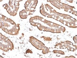 Villin 1, Mouse anti-Human, Clone: rVIL1/1325, Novus Biologicals 20 ug;