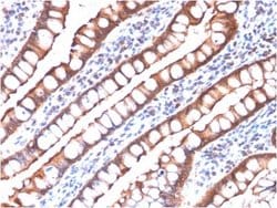 Villin 1, Mouse anti-Human, Clone: rVIL1/1325, Novus Biologicals 20 ug;