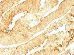 Villin 1 Antibody (VIL1/1314), Novus Biologicals:Antibodies:Primary Antibodies