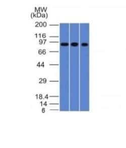 Villin 1 Antibody (VIL1/1314), Novus Biologicals:Antibodies:Primary Antibodies