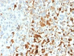 Vimentin Rabbit anti-Human, Rat, Porcine, Bovine, Canine, Chicken, Equine,