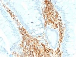 Vimentin Rabbit anti-Human, Rat, Porcine, Bovine, Canine, Chicken, Equine,