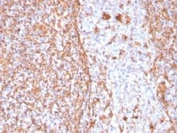 Vimentin Rabbit anti-Human, Rat, Porcine, Bovine, Canine, Chicken, Equine,