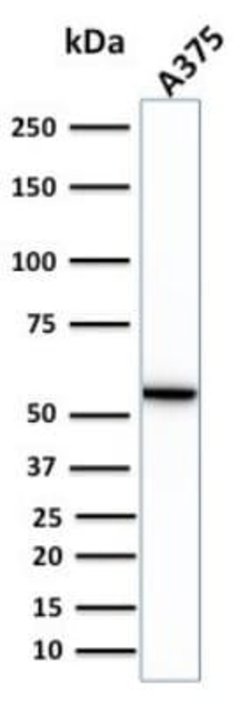 Vimentin Rabbit anti-Human, Rat, Porcine, Bovine, Canine, Chicken, Equine,