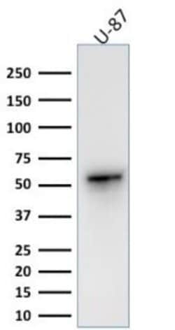 Vimentin Rabbit anti-Human, Rat, Porcine, Bovine, Canine, Chicken, Equine,