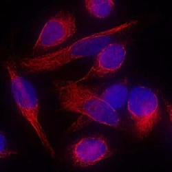 Vimentin Antibody (979542), Unconjugated, Novus Biologicals 25ug; Unconjugated:Antikörper