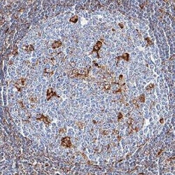 Vimentin Antibody (979542), Unconjugated, Novus Biologicals 25ug; Unconjugated:Antikörper