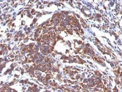 Vimentin Antibody (LN-6), Novus Biologicals 0.1mg; Unlabeled:Antibodies,