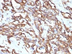 Vimentin Antibody (VM1170), Novus Biologicals:Antibodies:Primary Antibodies