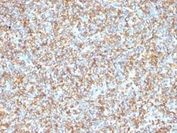 Vimentin Antibody (VM1170), Novus Biologicals:Antibodies:Primary Antibodies