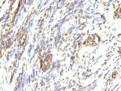 Vimentin Antibody (VM1170), Novus Biologicals:Antibodies:Primary Antibodies