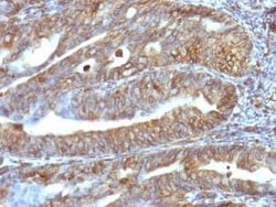 Vimentin Antibody (VM1170), Novus Biologicals:Antibodies:Primary Antibodies