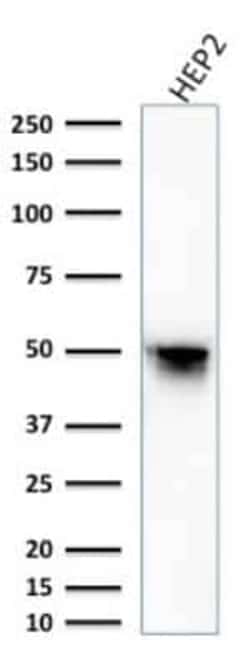 Vimentin Antibody (VM1170), Novus Biologicals:Antibodies:Primary Antibodies