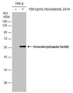 Vimentin, p Ser56 Antibody (GT11512), Novus Biologicals 100 &mu;g; Unconjugated:Antibodies,