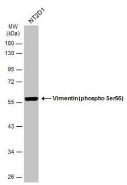 Vimentin, p Ser56 Antibody, Novus Biologicals 100 &mu;g | Buy Online | Novus Biologicals | Fisher Scientific
