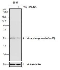 Vimentin, p Ser56 Antibody, Novus Biologicals 100 &mu;g | Buy Online | Novus Biologicals | Fisher Scientific
