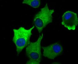 Vinculin Rabbit anti-Human, Mouse, Rat, Clone: JM42-43, Novus Biologicals