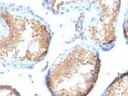 Vinculin, Mouse anti-Human,Mouse, Clone: VCL/2573, Novus Biologicals 20