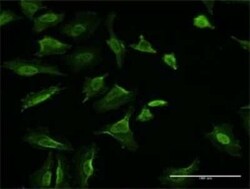 Vinculin Antibody (3F8-1D4), Novus Biologicals 0.1 mg | Buy Online | Novus Biologicals | Fisher Scientific