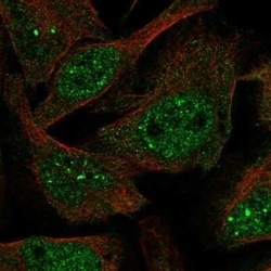 Virilizer Antibody, Novus Biologicals 0.1 mL; Unconjugated:Antibodies,