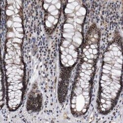 Virilizer Antibody, Novus Biologicals 0.1 mL; Unconjugated:Antibodies,