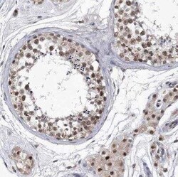 Virilizer Antibody, Novus Biologicals 0.1 mL; Unconjugated:Antibodies,