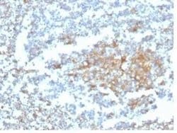 Vitamin D BP Mouse anti-Human, Clone: VDBP/4482, Novus Biologicals 100