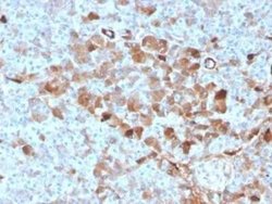Vitamin D BP Mouse anti-Human, Clone: VDBP/4482, Novus Biologicals 100