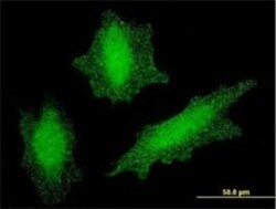 Von Hippel Lindau Antibody (1G12), Novus Biologicals 0.1 mg | Buy Online | Novus Biologicals | Fisher Scientific