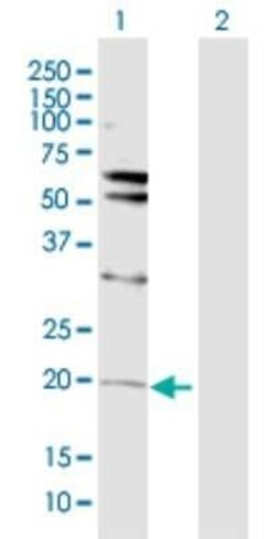 Von Hippel Lindau Antibody, Novus Biologicals 0.1 mg | Buy Online | Novus Biologicals | Fisher Scientific