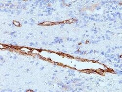 Von Willebrand Factor Antibody (IIIE2.34), Novus Biologicals 0.1mg; Unlabeled:Antibodies,