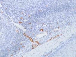 Von Willebrand Factor Antibody (IIIE2.34), Novus Biologicals 0.1mg; Unlabeled:Antibodies,