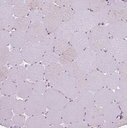 Von Willebrand Factor Antibody, Novus Biologicals 0.1 mL; Unconjugated:Antibodies,