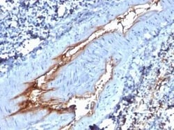 Von Willebrand Factor Antibody (VWF/1767), Novus Biologicals 100&mu;g;