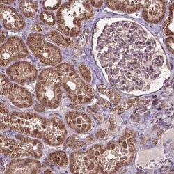 VprBP Antibody, Novus Biologicals:Antibodies:Primary Antibodies