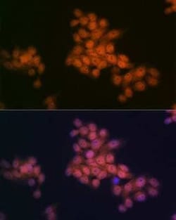 WAPL Rabbit anti-Human, Mouse, Clone: 3Q4G1, Novus Biologicals:Antibodies:Primary