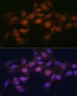 WAPL Rabbit anti-Human, Mouse, Clone: 3Q4G1, Novus Biologicals:Antibodies:Primary