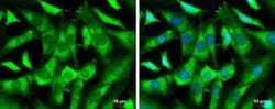 WASF1/WAVE1 Antibody, Novus Biologicals 100 &mu;g; Unconjugated:Antibodies,
