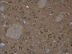 WASF1/WAVE1 Antibody, Novus Biologicals 100 &mu;g; Unconjugated:Antibodies,