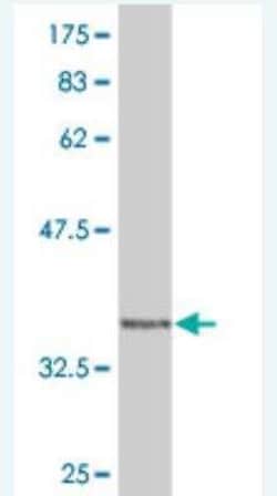 WASP Antibody (3H5), Novus Biologicals 0.1 mg | Buy Online | Novus Biologicals | Fisher Scientific
