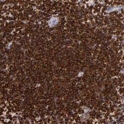 WASP Antibody, Novus Biologicals 25 &mu;L; Unconjugated:Antibodies, Polyclonal