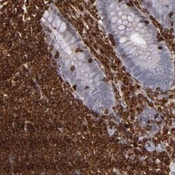 WASP Antibody, Novus Biologicals 25 &mu;L; Unconjugated:Antibodies, Polyclonal