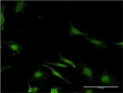 WBP2 Antibody (3B1), Novus Biologicals 0.1 mg | Buy Online | Novus Biologicals | Fisher Scientific
