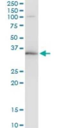 WBSCR22 Antibody (2E12), Novus Biologicals 0.1 mg | Buy Online | Novus Biologicals | Fisher Scientific